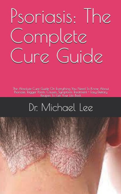 Psoriasis: The Complete Cure Guide : The Absolute Cure Guide On ...