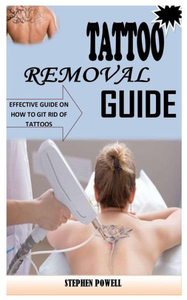 TATTOO REMOVAL GUIDE: EFFECTIVE GUIDE ON HOW TO GIT RID OF TATTOOS