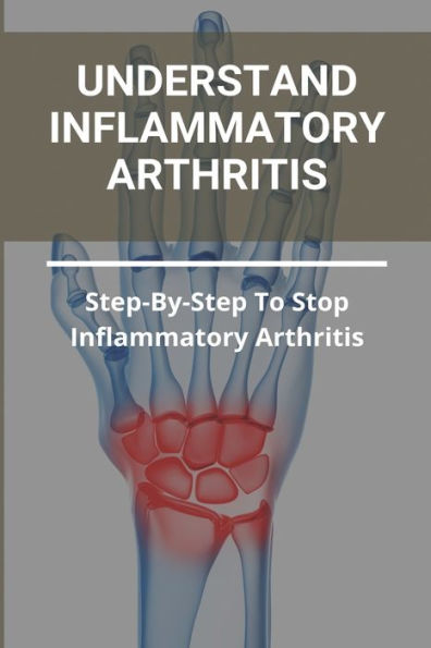 Understand Inflammatory Arthritis: Step-By-Step To Stop Inflammatory Arthritis: Unusual Symptoms Of Rheumatoid Arthritis