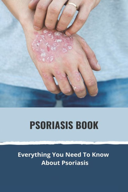 Psoriasis Book: Everything You Need To Know About Psoriasis: Psoriasis ...