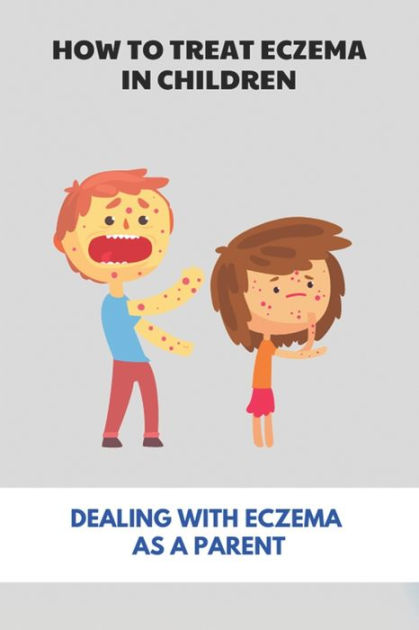 How To Treat Eczema In Children: Dealing With Eczema As A Parent ...