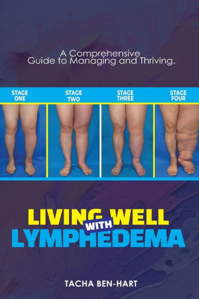 LIVING WELL WITH LYMPHEDEMA: A Comprehensive Guide to Managing and Thriving