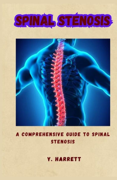 SPINAL STENOSIS: A COMPREHENSIVE GUIDE TO SPINAL STENOSIS