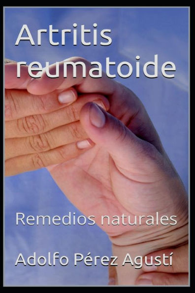 Artritis reumatoide: Remedios naturales