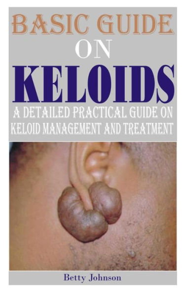BASIC GUIDE ON KELOIDS: A detailed practical guide on keloid management and treatment