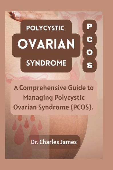 Polycystic Ovarian Syndrome PCOS: A Comprehensive Guide to Managing Polycystic Ovarian Syndrome PCOS