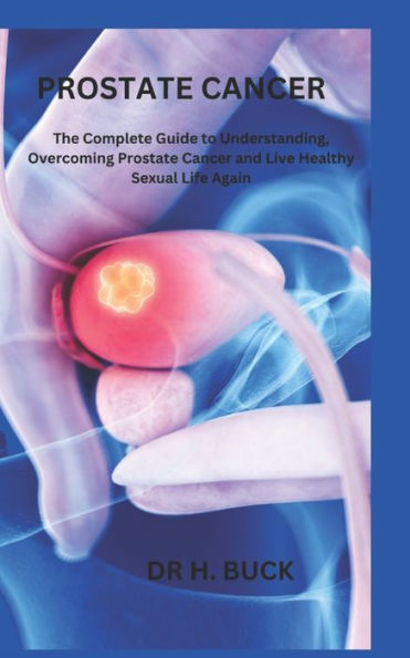 Prostate Cancer The Complete Guide To Understanding Overcoming Prostate Cancer And Live 5861