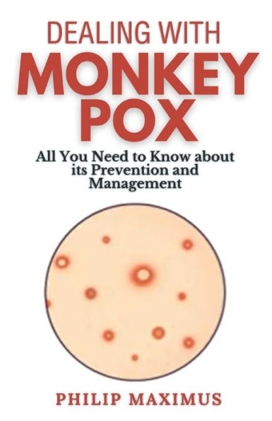 Dealing with MonkeyPox: All You Need to Know about its Prevention and Management