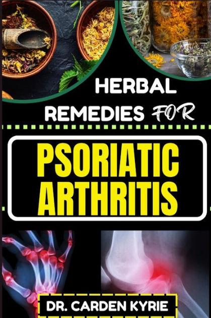 HERBAL REMEDIES FOR PSORIATIC ARTHRITIS: Empower Your Journey To ...