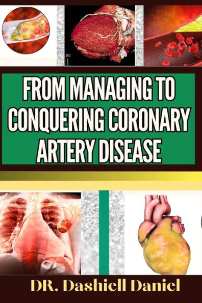 FROM MANAGING TO CONQUERING CORONARY ARTERY DISEASE: Expert Guide To Understanding The Causes, Recognizing Symptoms, And Implementing Effective Treatments For A Heart-Healthy Lifestyle