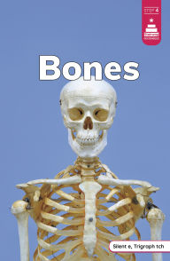 Title: Bones, Author: Laura Stickney