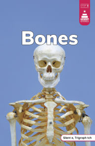 Title: Bones, Author: Laura Stickney