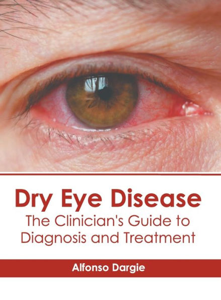 Dry Eye Disease: The Clinician's Guide to Diagnosis and Treatment