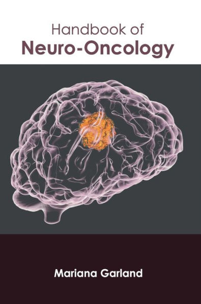 Handbook of Neuro-Oncology