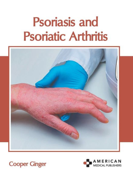 Psoriasis and Psoriatic Arthritis