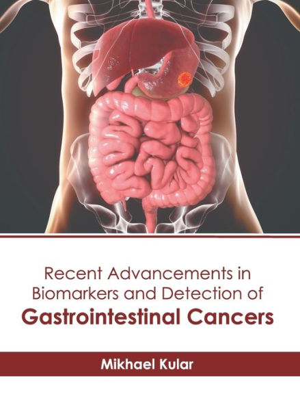 Recent Advancements in Biomarkers and Detection of Gastrointestinal Cancers