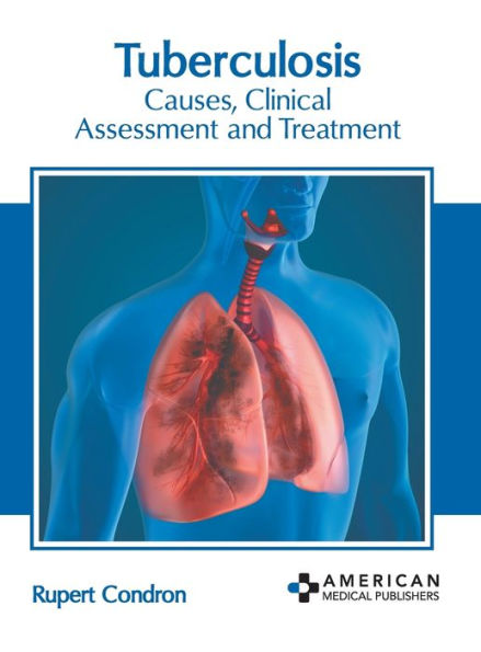 Tuberculosis: Causes, Clinical Assessment and Treatment