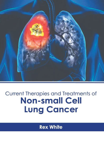 Current Therapies and Treatments of Non-small Cell Lung Cancer