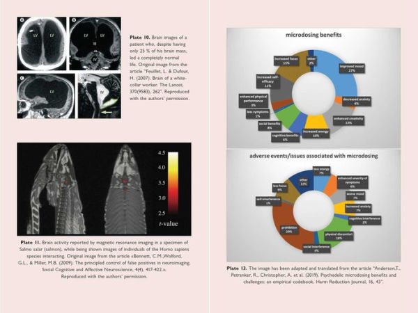 The Neuroscience of Psychedelics: Pharmacology What Makes Us Human