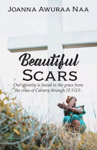 Beautiful Scars: Our Identity is Found the Grace from Cross of Calvary through Jesus