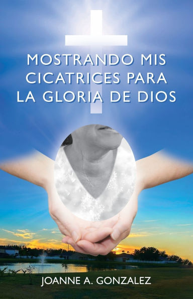 Mostrando mis cicatrices para la Gloria de Dios