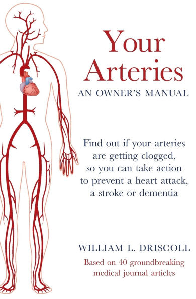 your Arteries-An Owner's Manual: Find out if arteries are getting clogged, so you can take action to prevent a heart attack, stroke or dementia