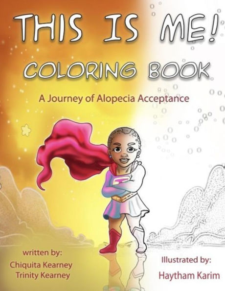 This Is Me Coloring Book: A Jouney of Alopecia Acceptance: A Jouney of Alopecia Acceptance: A Jouney of Alopecia Acceptance: A Jouney of Alopecia Acceptance