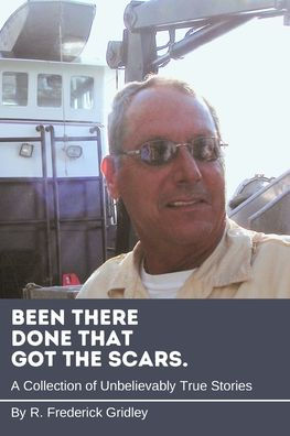 Been There, Done That, Got the Scars: A Collection of Unbelievably True Stories
