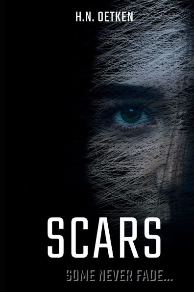 Scars: some never fade...
